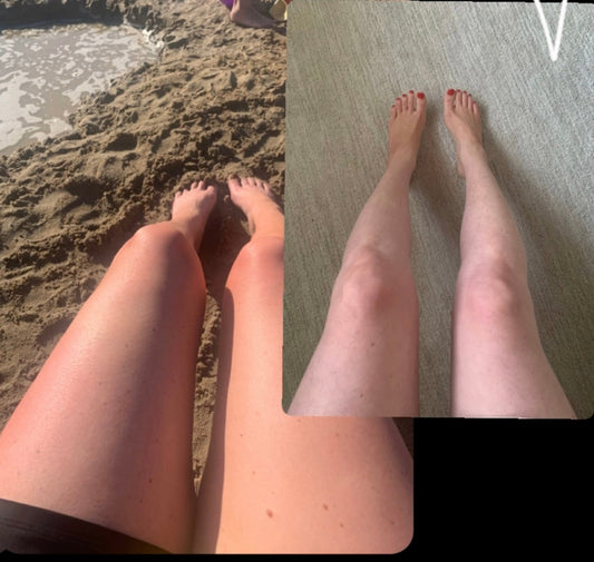 Why Sensitive Skin Needs a Different Kind of Tanner